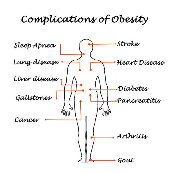 Complicaciones de la obesidad —  Fotos de Stock