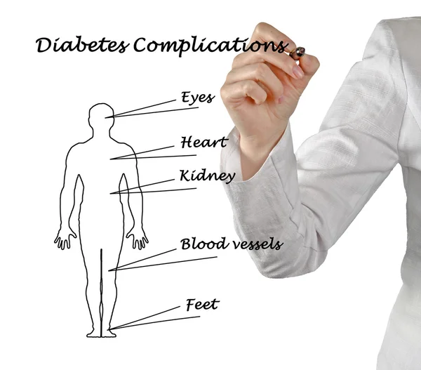 Complicações do diabetes — Fotografia de Stock