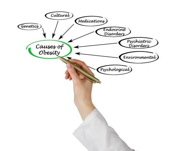 Causas da obesidade — Fotografia de Stock