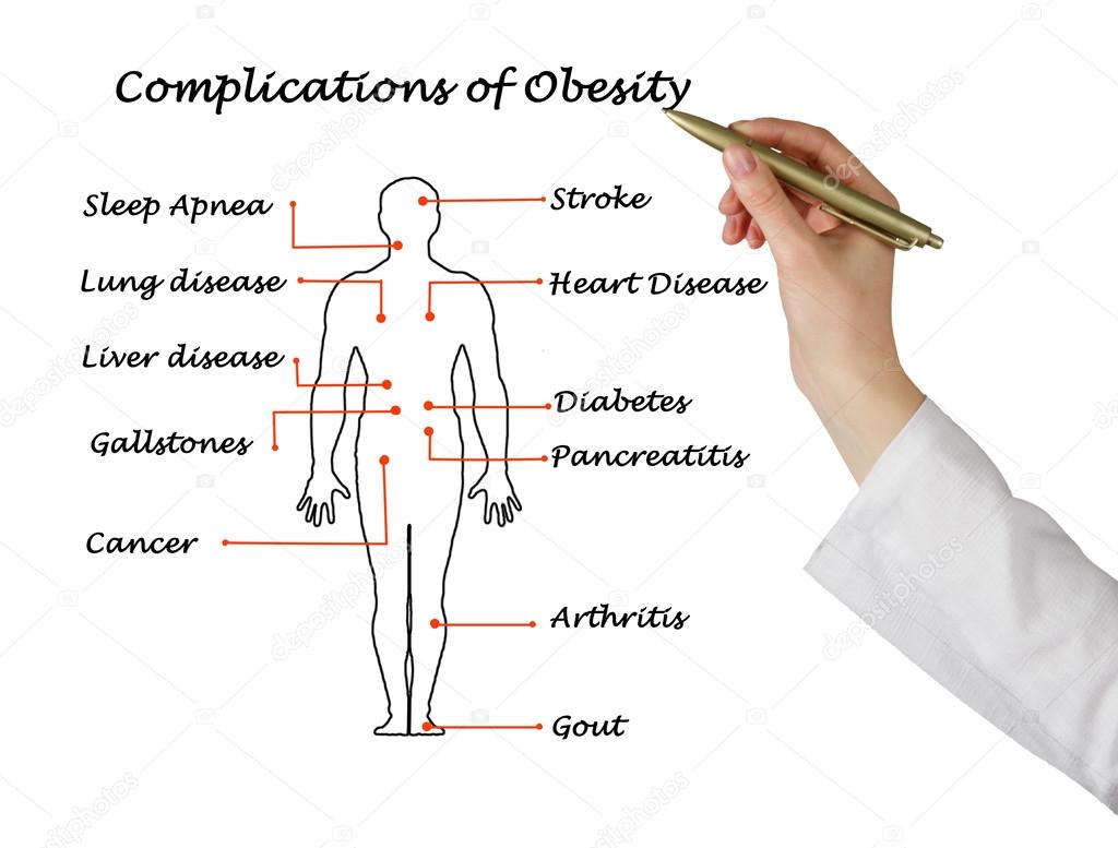 Complications of Obesity