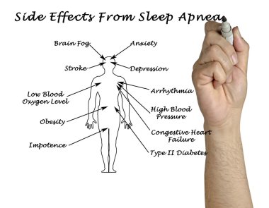 Yan etkileri uyku apnesi