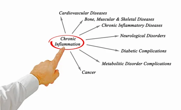 Inflamação crónica — Fotografia de Stock