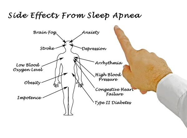 Vedlejší účinky spánkové apnoe — Stock fotografie