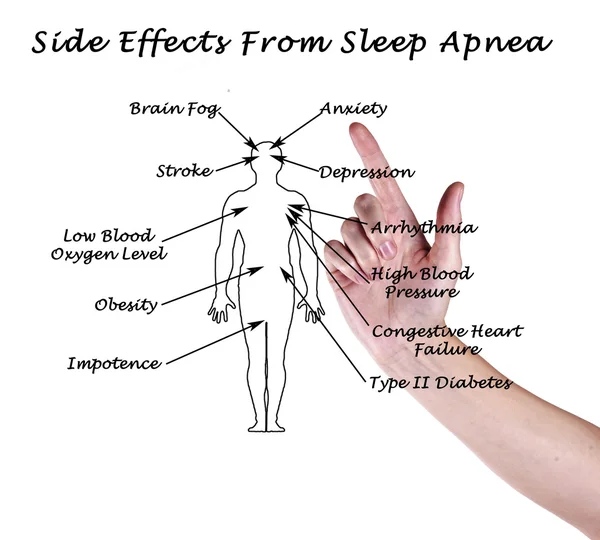 睡眠呼吸暂停的副作用 — 图库照片