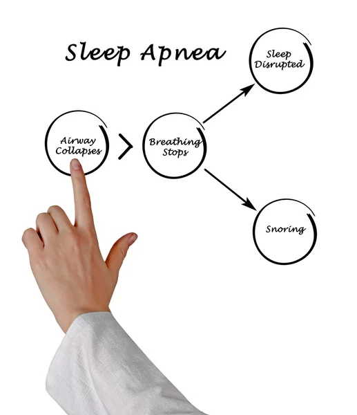 Sleep apnea Pictures, Sleep apnea Stock Photos & Images Depositphotos®