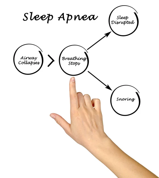 Sleep Apnea — Stock Photo, Image