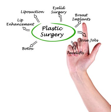 Plastik cerrahi diyagramı