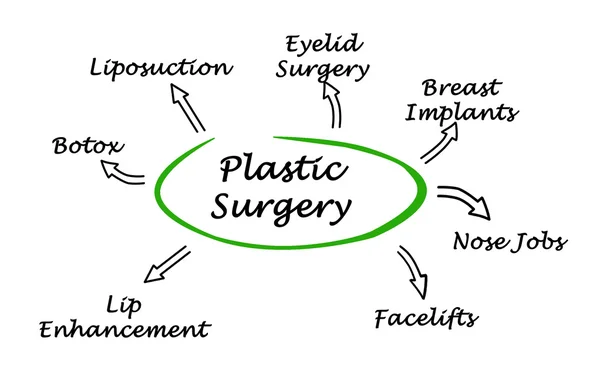 Diagramm der plastischen Chirurgie — Stockfoto