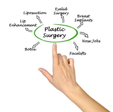 Plastik cerrahi diyagramı
