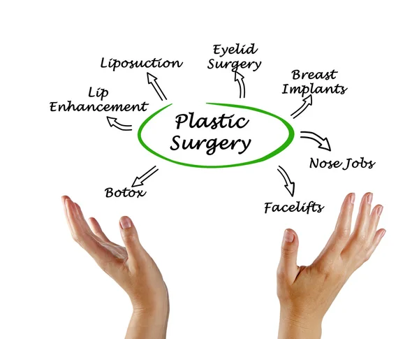 Диаграмма пластической хирургии — стоковое фото