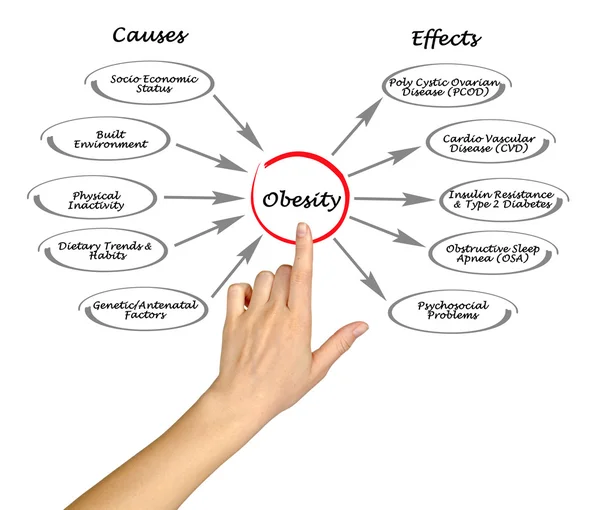 Obesidad: causas y efectos — Foto de Stock