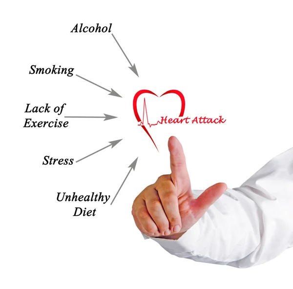 Diagram of  Causes of heart attack — Stock Photo, Image
