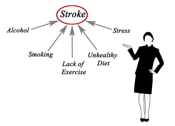 Diagramme des causes de l'AVC — Photo