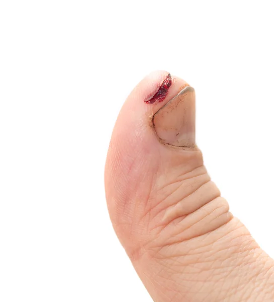 Verletzter Finger mit schmutzigem offenen Schnitt — Stockfoto