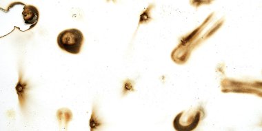 Yangın delik teknik inceleme