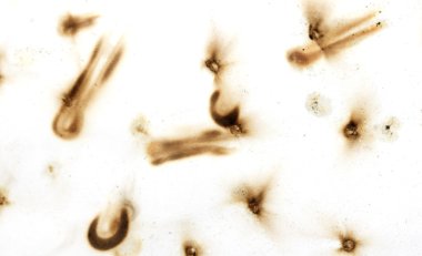 Yangın delik teknik inceleme