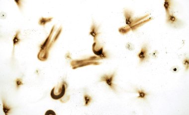 Yangın delik teknik inceleme