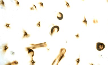 Yangın delik teknik inceleme