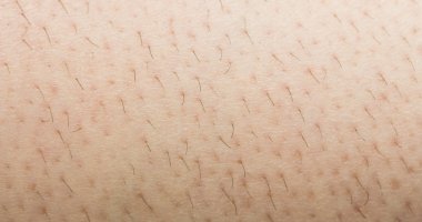 Derideki varis damarları.