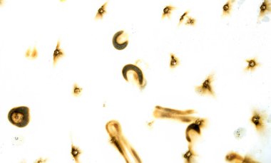 The image is a close up of a white background with many small black dots scattered throughout. The dots are all different sizes and shapes, creating a sense of chaos and disorder