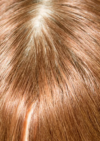 Haare auf dem menschlichen Kopf — Stockfoto