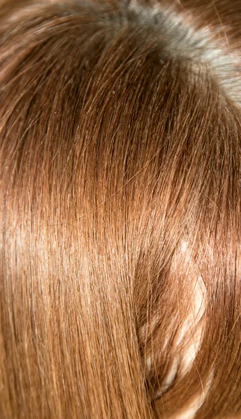 Az emberi fej haj — Stock Fotó