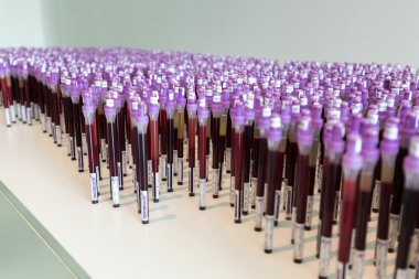 Cracow - Mocak Çağdaş Sanat Müzesi. Yeni sergi - Art tıpta. Edith Micansky, Esr (Bsg), 2004, yükleme