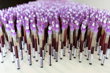 Cracow - Mocak Çağdaş Sanat Müzesi. Yeni sergi - Art tıpta. Edith Micansky, Esr (Bsg), 2004, yükleme