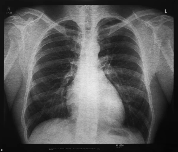 Medical Chest X Ray Stock Image