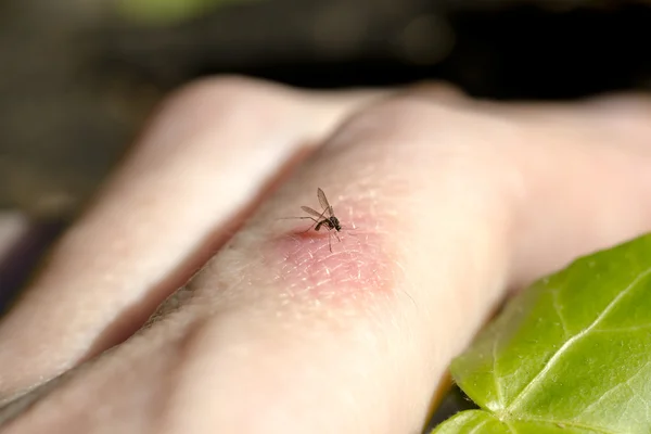 Mosquito kousání prstů — Stock fotografie