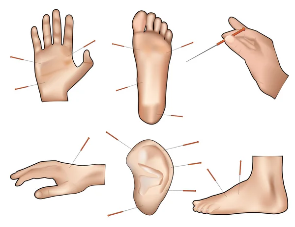 Acupuntcture vektör çizim