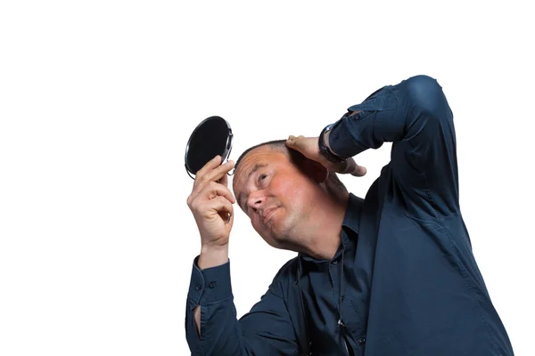 Man has a Hair loss — Stock Photo, Image