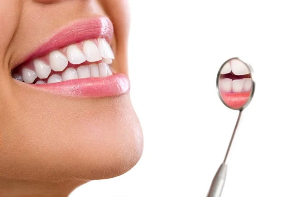 Dientes de mujer sanos — Foto de Stock