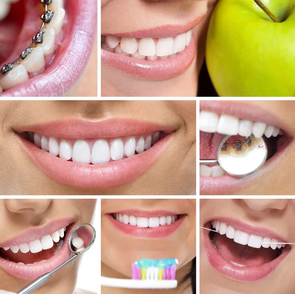 Dentes e sorriso colagem — Fotografia de Stock