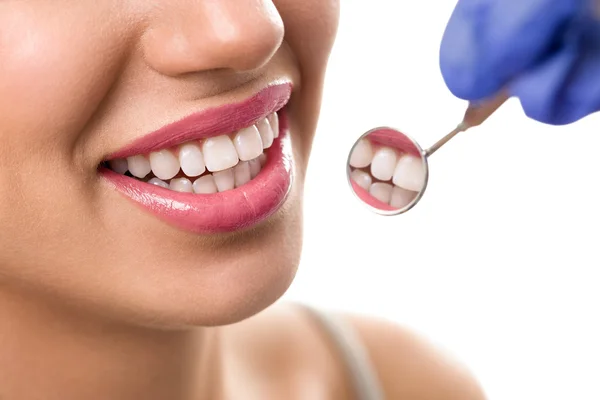Vackert leende med tandläkare spegel — Stockfoto