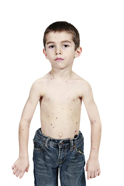 Chory chłopczyk — Zdjęcie stockowe