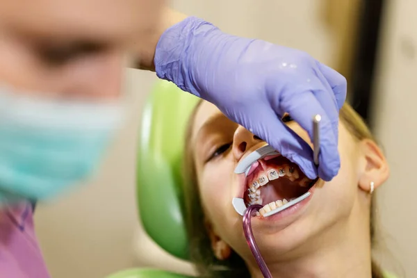 十几岁的女孩在牙医那里 她坐在牙医的椅子上 牙医在她的牙齿上套上了牙套 — 图库照片