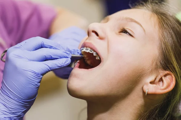 Genç Kız Dişçide Dişçi Koltuğunda Oturuyor Dişçi Dişlerine Diş Teli — Stok fotoğraf