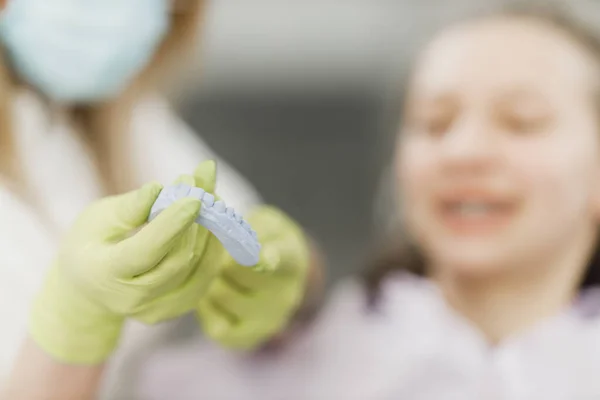 Primo Piano Dentista Irriconoscibile Che Tiene Stampo Gesso Dentale Durante — Foto Stock