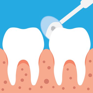 düz stil içinde diş incelemesi