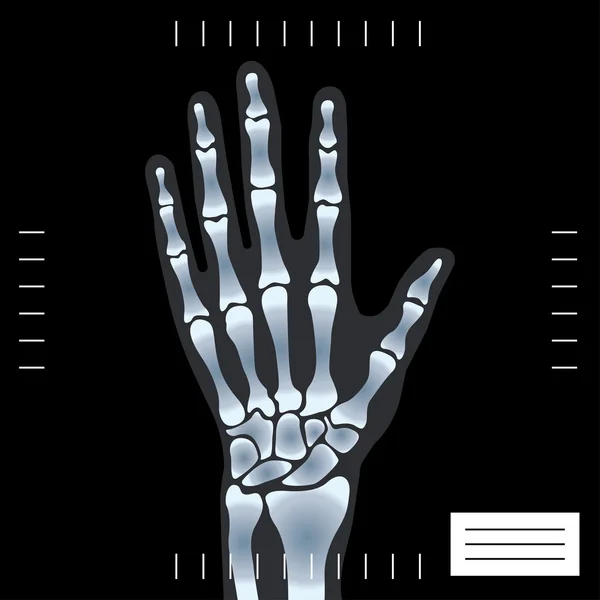 X-ray hand — Stock Vector