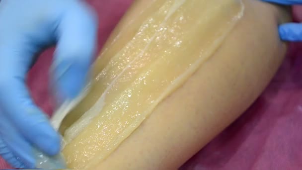 Sugaring epilering med liquate socker i kosmetiska salong. — Stockvideo