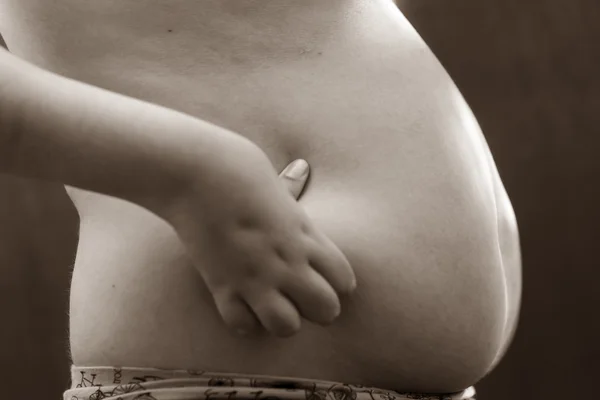 Niño obesidad infantil 12 años el cuerpo del estómago. metaboli — Foto de Stock