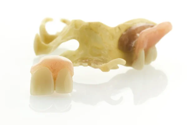 Old denture isolated — Stock Photo, Image