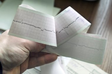 Doktorun elinde hastanın EKG 