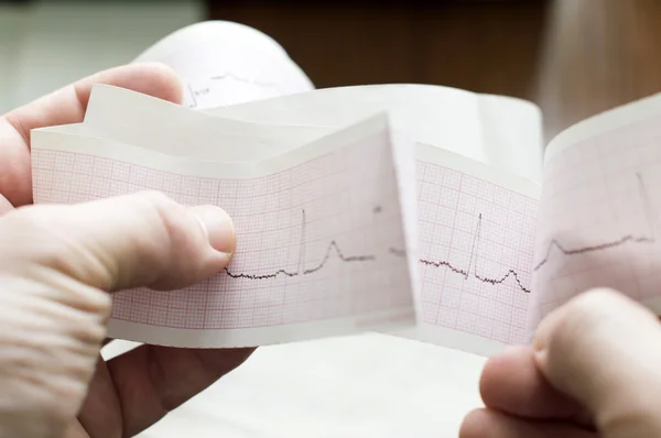 EKG pacjenta w ręce lekarza — Zdjęcie stockowe