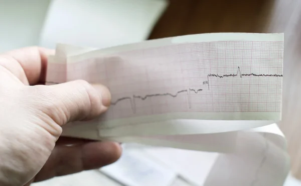 ECG del paciente en manos del médico — Foto de Stock