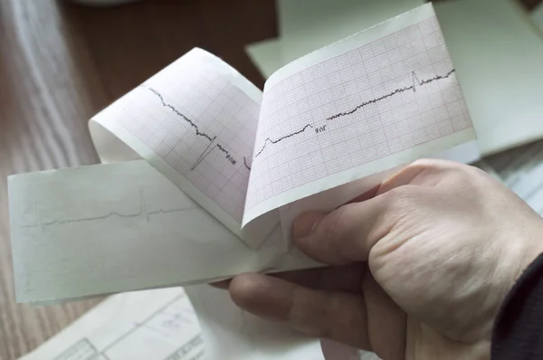 EKG pacjenta w ręce lekarza — Zdjęcie stockowe