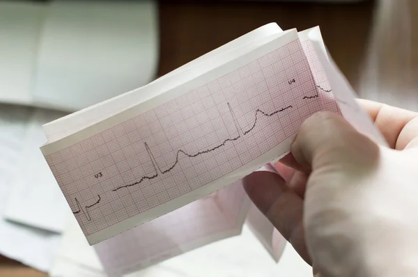 A beteg az orvos kezében EKG — Stock Fotó