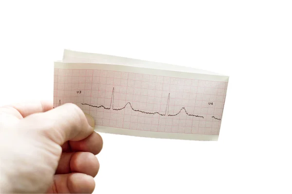 ECG del paciente en la mano del médico — Foto de Stock